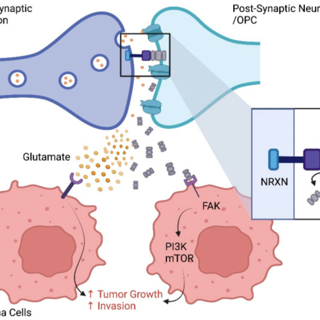 Interdependencies of the Neuronal, Immune and Tumor Microenvironment in Gliomas