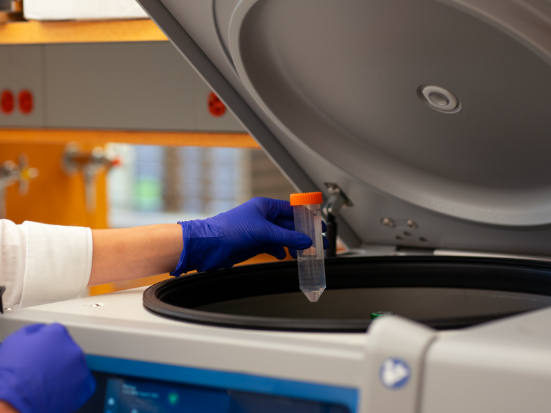 Adding a biological sample to a large volume centrifuge