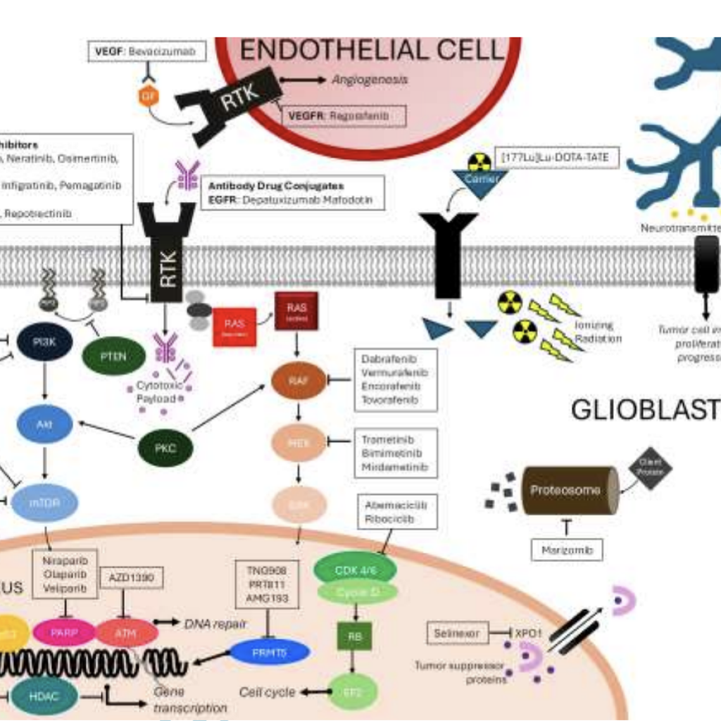 Glioblastoma in Adults: A Society for Neuro-Oncology (SNO) and European Society of Neuro-Oncology (EANO) Consensus Review on Current Management and Future Directions