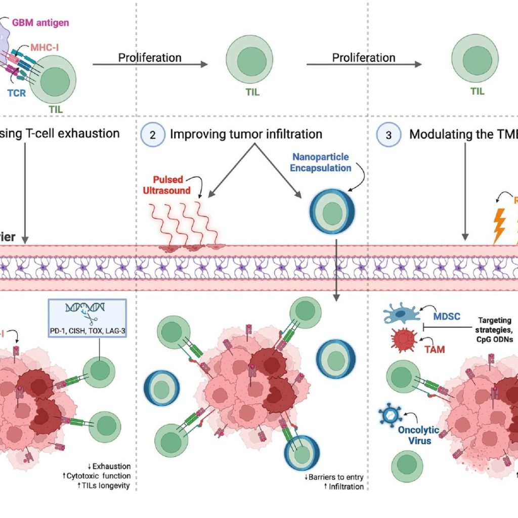 The Promise of TIL Therapy for Glioblastoma